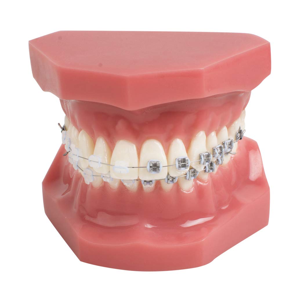 YOUYA Dental TM-208 Demonstration Orthodontic Model Teeth Teach Study Tools with Metal and Ceramic Bracket(Red)