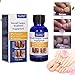 Nail Repair, Nail Solution, Natural Nail Treatment, Effective Against Nail Infection Restores Discolored & Damaged Nails