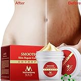 Stretch Marks Scar Removal Smooth Skin Repair Cream Effectively Remove Pregnancies Grain Improving Flabby Dark Skin For Pregnant Skin