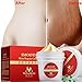 Stretch Marks Scar Removal Smooth Skin Repair Cream Effectively Remove Pregnancies Grain Improving Flabby Dark Skin For Pregnant Skin