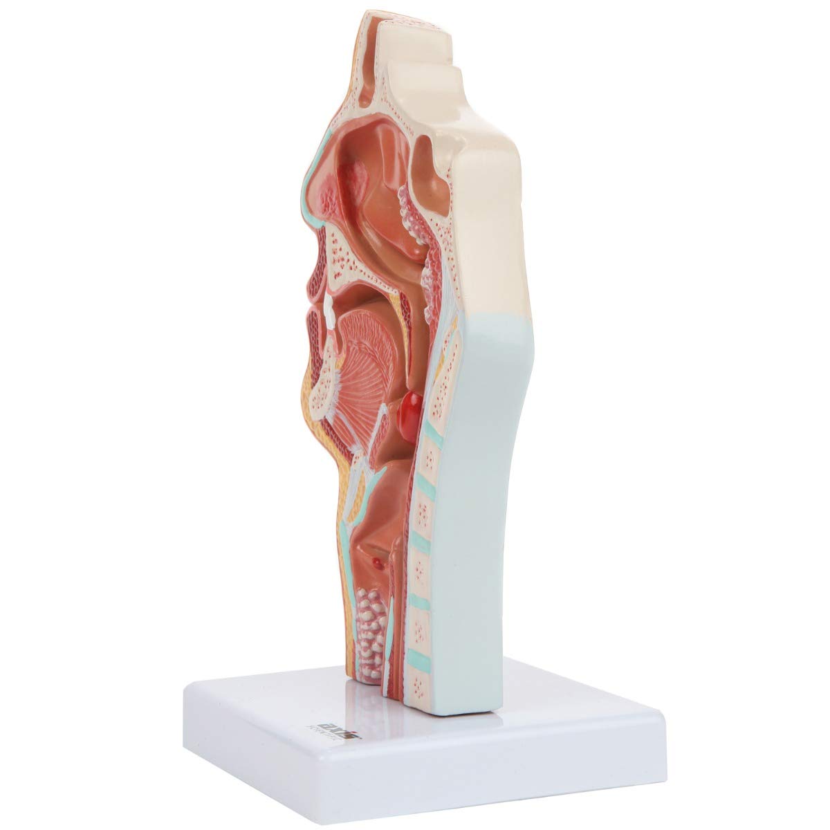 Axis Scientific Human Larynx and Pharynx Disorders Model | Shows Normal Larynx and Pharynx Anatomy and Details Common Abnormalities | Comes on White Base