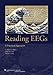 Reading EEGs: A Practical Approach