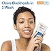 AcneFree Blackhead Removing Exfoliating Face Scrub with 2% Salicylic Acid and Charcoal Jojoba, 5 Ounce - Pack of 2