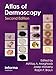 An Atlas of Dermoscopy
