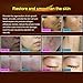 Wisdompark Acne Scar Removal Cream Skin Repair Face Cream Acne Spots Acne Treatment Blackhead Whitening Cream Stretch Marks 30ml (2pcs)