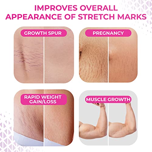 Lure Essentials Fade Stretch Marks Cream - Stretch Marks Remover Cream and Stretch Mark Prevention Cream for Pregnancy with Cocoa Butter
