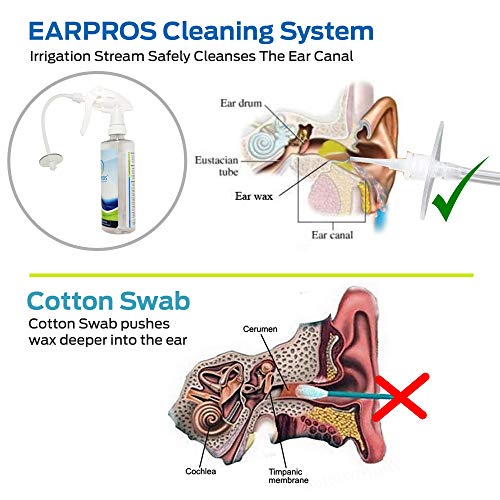 Premium Ear Cleaning System (White) with Catch Basin & 5 Tips Cerumen