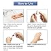 Skin Tag Remover,Skin Tag Removal,Liquid Warts Tag Mole Remover for Removing Skin Tags 2 Pcs