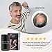 Miracle Hair – Hair Loss Concealer – Highest Quality Natural Hair Building Fibers Thickens Thinning Hair Instantly for Men And Women 10 Grams (30 Day Supply)