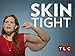 My 600-lb Life: Skin Tight Season 1