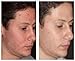 Vernal Age-Defying Microdermabrasion - Advanced Face Exfoliating Scrub - Evens Out Skin Tone, Improve Skin Texture Reduce Acne & Get Rid Of Blackheads.