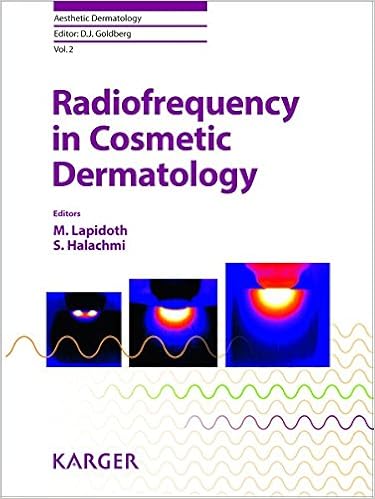 Radiofrequency in Cosmetic Dermatology (Aesthetic Dermatology, Vol. 2) Radiofrequency in Cosmetic Dermatology (Aesthetic Dermatology, Vol. 2)