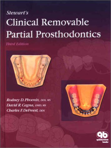 Stewart's Clinical Removable Partial Prosthodontics (Phoenix, Stewart's Clinical Removable Partial Prosthodontics)