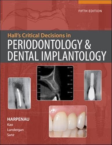Download Hall’s Critical Decisions in Periodontology PDF