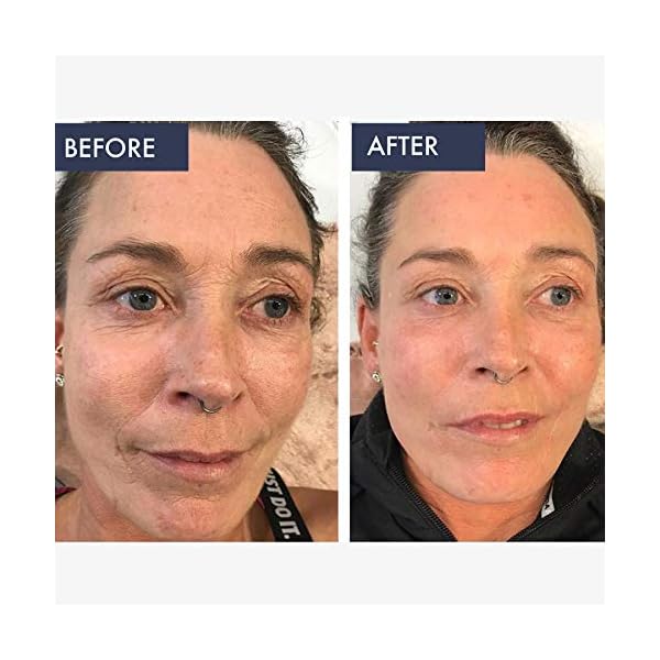 biobare retinol