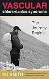 Vascular Ehlers-Danlos Syndrome: The Journey Begins by M J Smith