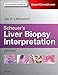 Scheuer's Liver Biopsy Interpretation