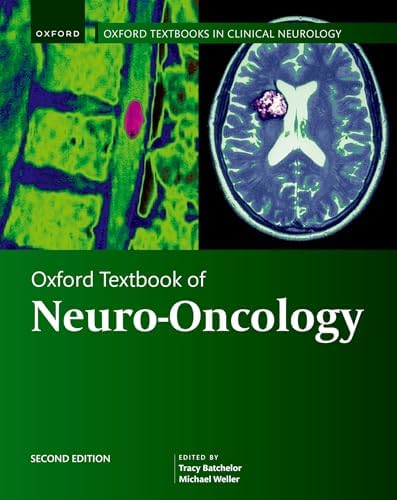 Handbook of Neuro-Oncology Neuroimaging: 9780128228357: Medicine