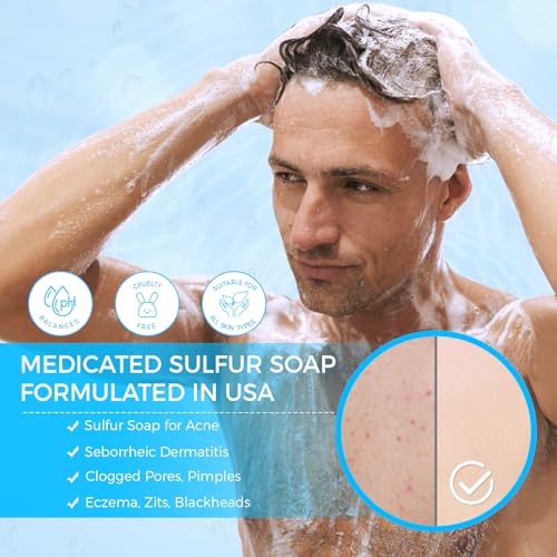 OUKEYA Sulfur Soap for Face and Body with 10% Sulfur, 2% Salicylic Acid, Sulphur Soap Bar with Goat Milk & Tea Tree Oil Hydrating Aloe & Hyaluronic Acid