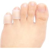 corn on inside of little toe