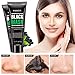 Vassoul Blackhead Remover Mask, Deep Pore Cleansing for Face Nose Acne Treatment Oil Control (50g)