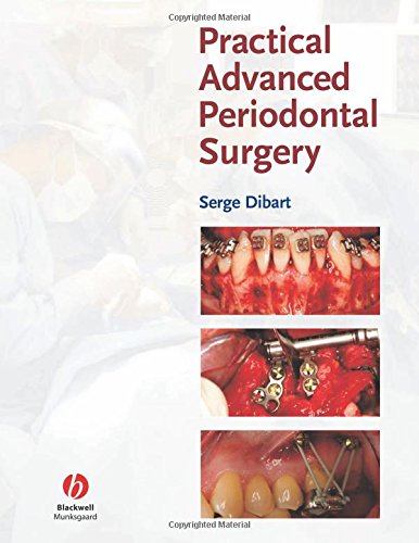 Practical Advanced Periodontal Surgery, by Serge Dibart