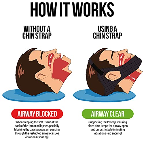 Anti Snoring Chin Strap for CPAP Users Multiple Sizes for Men or