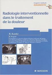 Radiologie interventionnelle dans le traitement de la douleur