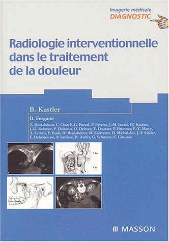 Radiologie interventionnelle dans le traitement de la douleur