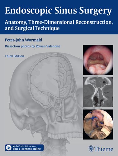 ENDOSCOPIC SINUS SURGERY