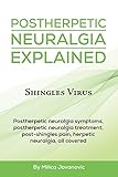 Postherpetic Neuralgia Explained: Shingles virus, Postherpetic neuralgia symptoms, postherpetic neuralgia treatment, post-shingles pain, herpetic neuralgia, all covered