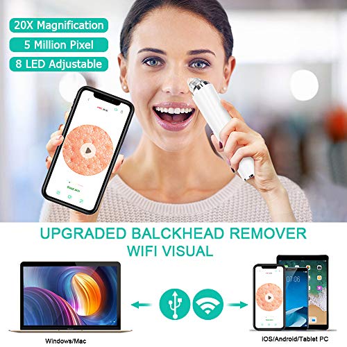 Blackhead Remover Vacuum with Camera, TIMESISO Visible Acne Comedone