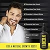 LINCOLN-Biotin-Hair-Growth-Serum-For-Men-Biotin-Hair-Serum-For-Hair-Loss-Thin-Hair-Treatment-Enriched-With-Hair-Vitamins-for-Growth-and-Hair-Loss-Natural-Hair-Loss-Treatment-For-Men-50-ml LINCOLN Biotin Hair Growth Serum - Hair Oil & Hair Serum, Providing Optimum Hair Care & Hair Growth Vitamins - Hair…