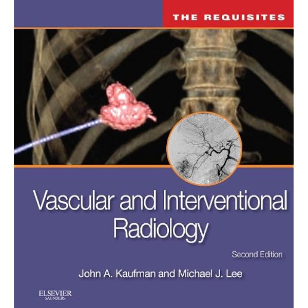 Amazon.com: Image-Guided Interventions E-Book: Expert Radiology