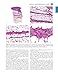 Cutaneous Soft Tissue Tumors