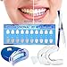 Teeth Whitening Kit,Home Teeth Whitening Kit,Teeth Whiten Gel Kit,White Dental Care GEL Tooth Bleaching Kit,Reusable Dental Whitening Kit,Teeth Whitening to Yellow Teeth and Smoke Marks Black Teeth