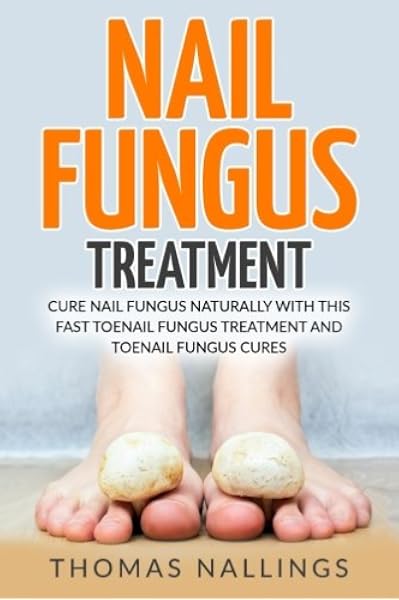 Nail Fungus Treatment Cure Nail Fungus Naturally With This Fast Toenail Fungus Treatment And Toenail Fungus Cures Nallings Thomas 9781539654193 Amazon Com Books