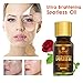 2 PACK Ultra Brightening Spotless Oil Skin Care Natural Pure Dark Spots Remove Ance Burn Strentch Marks Scar Removal Brightening Skin (10 ml) (spotless oil)