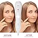 Portable Dark Spot Removal, Professional Tattoo Remover Tool for Skin Tag Freckles Dark Spot Skin Pigmentation with Replaceable Needles