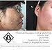 ASDM Beverly Hills 100 Percentage Pure Hyaluronic Acid Serum |4 Ounces| Hydrating Serum Improves the Visible Appearance of Firmness and Smoothness on Skin-Demolishes Wrinkles and Fine Lines