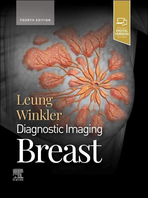 Breast Imaging: The Core Requisites: 9780323758499: Medicine