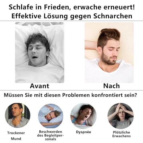 DOHUG Snore Splint, Adjustable Bite Splint Against Snoring and Crunching - Anti Snoring Snoring Stopper - Anti-Snoring Mouth Guard - Improves Sleep Quality (White Medium)