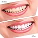 Teeth Whitening Strips Professional 3D Whitening Shine Teeth Advanced Double Elastic Gel Cleaning for Teeth Care28 Counts (14 Upper and 14 Lower Strips), Mint Flavor