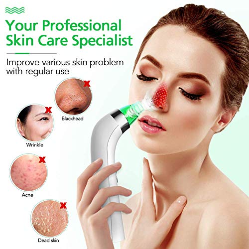 Blackhead Remover Pore Vacuum Cleaner LONOVE Upgraded Blackhead