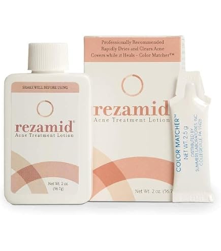 Amazon.com : Acne Treatment Lotion 2 oz (Pack of 2) : Beauty