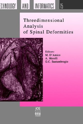 Threedimensional Analysis of Spinal Deformities, (Studies in Health Technology and Informatics)