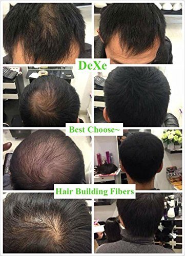 image for Classic Necessity Dexe Black Colored Hair Building Fibers - Thickening