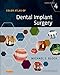 Color Atlas of Dental Implant Surgery