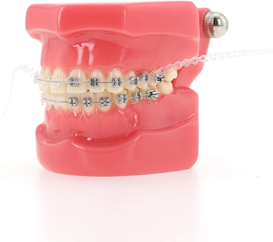 Colourful Dental Orthodontic Elastic Rubber Band Power Chain for Braces Short Long Continuous Sizes Orthodontic Treatment 1 pc (Open, White)