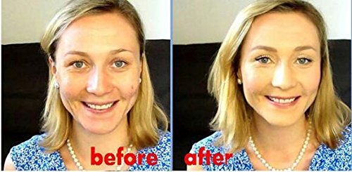 Beauty Glazed 24K GOLD INFUSED BEAUTY OIL Primer Foundation Rich in Vitamin A&E Moisturizing Anti-Aging Acne Treament acido